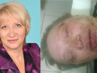 В Новочеркасске активистке ЛНР двое неизвестных отбили глаз и пытались разорвать рот