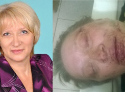 В Новочеркасске активистке ЛНР двое неизвестных отбили глаз и пытались разорвать рот