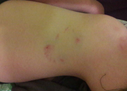 Чипированная собака напала и укусила мальчика в Новочеркасске