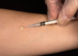 В Новочеркасских поликлиниках закончились противотуберкулезные препараты